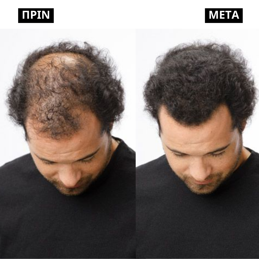 Livioon Keratin Complex Σετ - Σαμπουάν 250ml & Conditioner 250 ml
