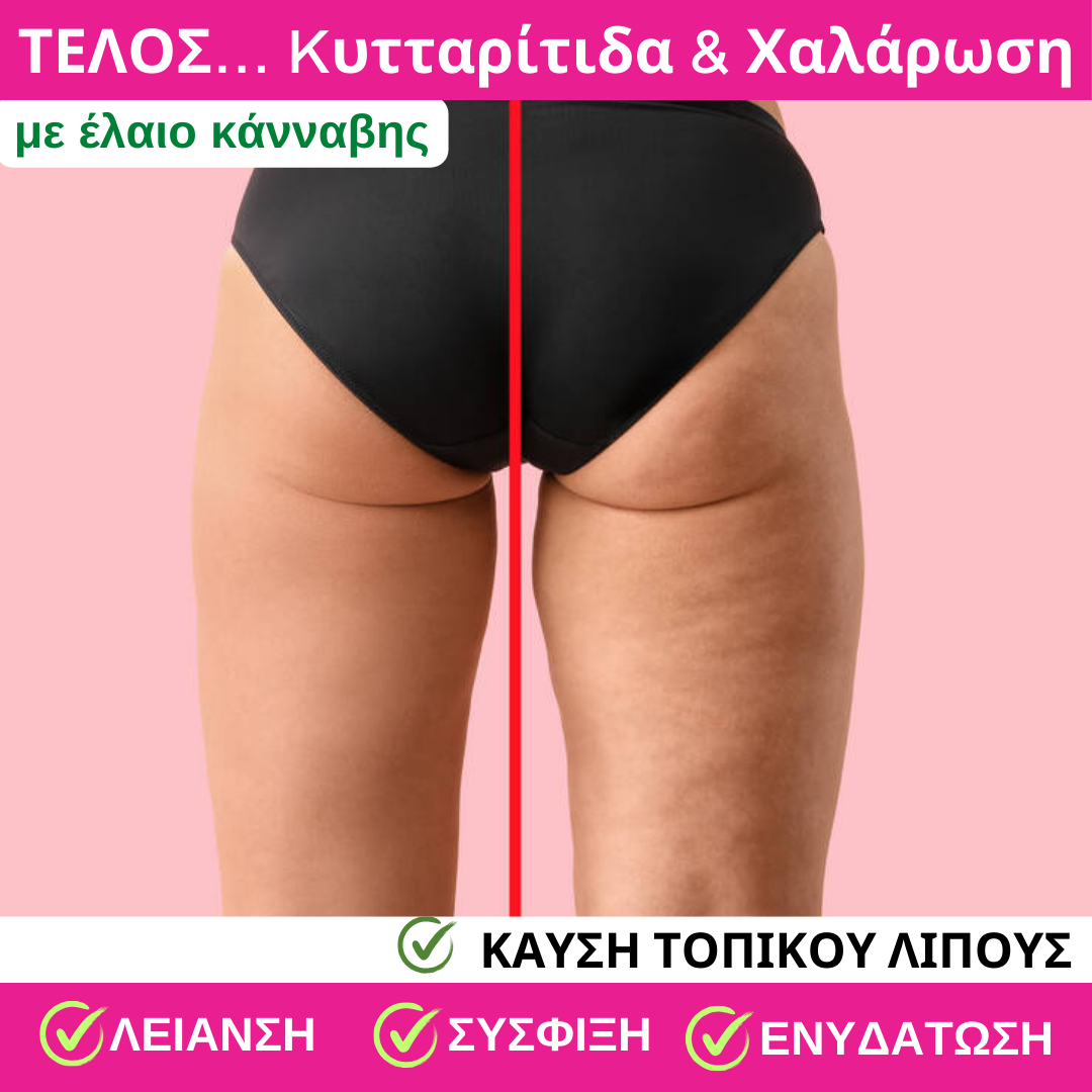 ΣΕΤ Κρέμα κατά της Kυτταρίτιδας & Χαλάρωσης 200 ml + Body Scrub 240gr